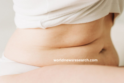 Cortisol Belly: Causes, Signs, and What to Know